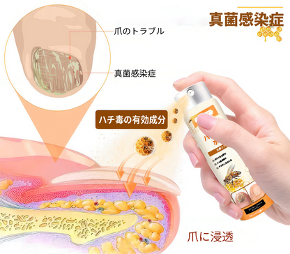 💥💥 2025年限定 70%OFF ⏳ UNPREE™ Kolirin ビーベノム爪真菌スプレー 💥 わずか2週間で爪のトラブルをすべて解消！