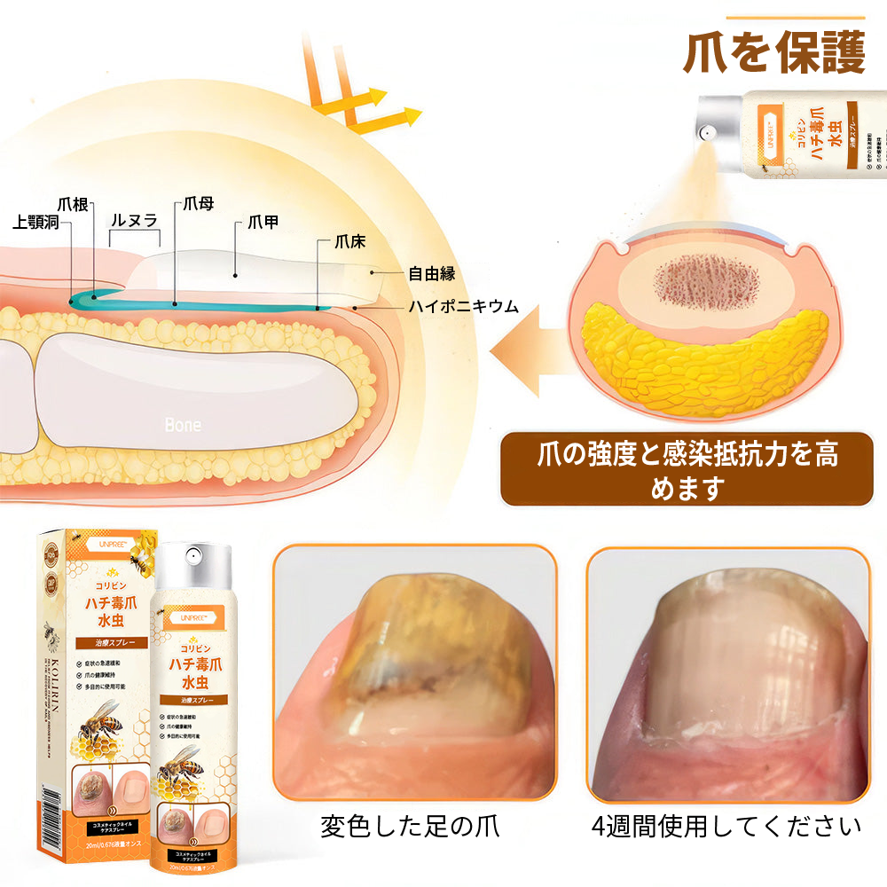 💥💥 2025年限定 70%OFF ⏳ UNPREE™ Kolirin ビーベノム爪真菌スプレー 💥 わずか2週間で爪のトラブルをすべて解消！