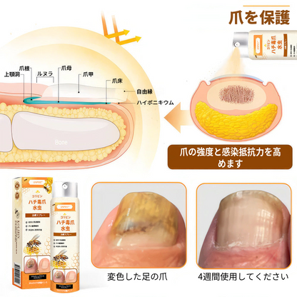 💥💥 2025年限定 70%OFF ⏳ UNPREE™ Kolirin ビーベノム爪真菌スプレー 💥 わずか2週間で爪のトラブルをすべて解消！