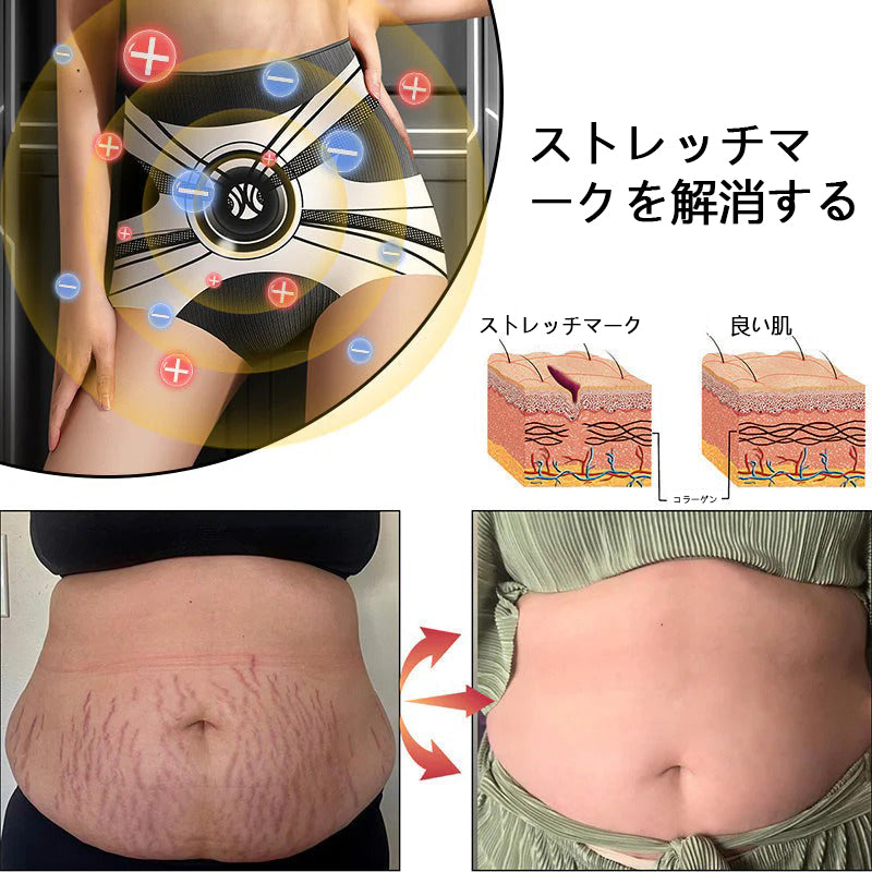 Anyidea® チタニウム トルマリン シェイプショーツ 💪 – 医療グレードのスリミング＆保温効果 🧊 | ⚡ 最大90％オフ – 本日限定！⏳