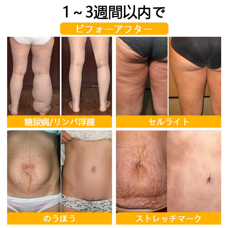 Anyidea® チタニウム トルマリン シェイプショーツ 💪 – 医療グレードのスリミング＆保温効果 🧊 | ⚡ 最大90％オフ – 本日限定！⏳