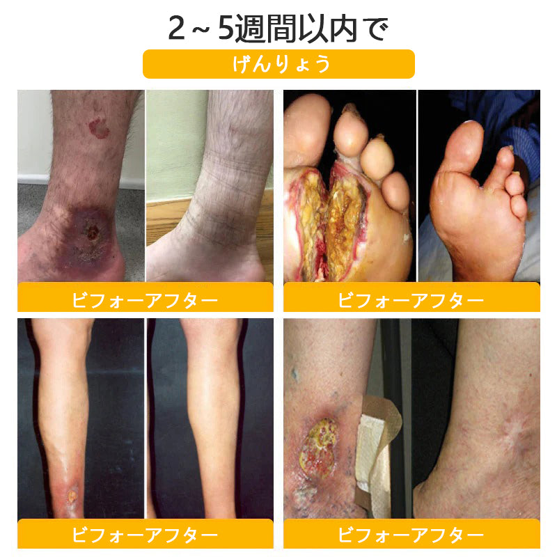 Anyidea® チタニウム トルマリン シェイプショーツ 💪 – 医療グレードのスリミング＆保温効果 🧊 | ⚡ 最大90％オフ – 本日限定！⏳